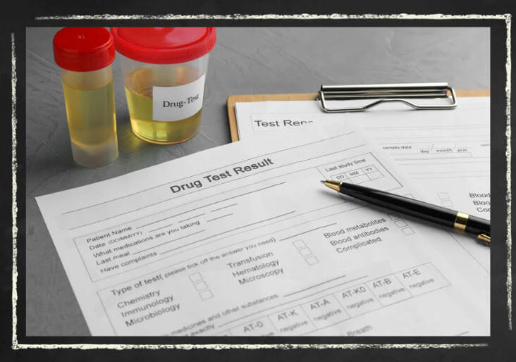 Drug test result papers with urine samples indicating random drug tests